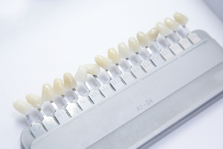 dental veneers used to match tooth color